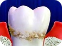 Alimentación contra la caries