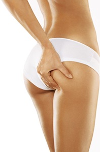 Consejos para combatir y eliminar la celulitis