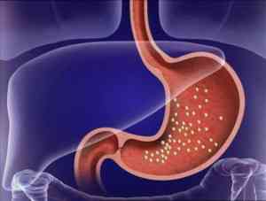 Gastritis emocional y nerviosa