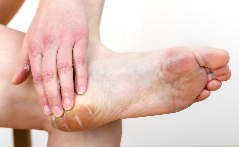 Cómo aliviar rozaduras zapatos con estos remedios naturales